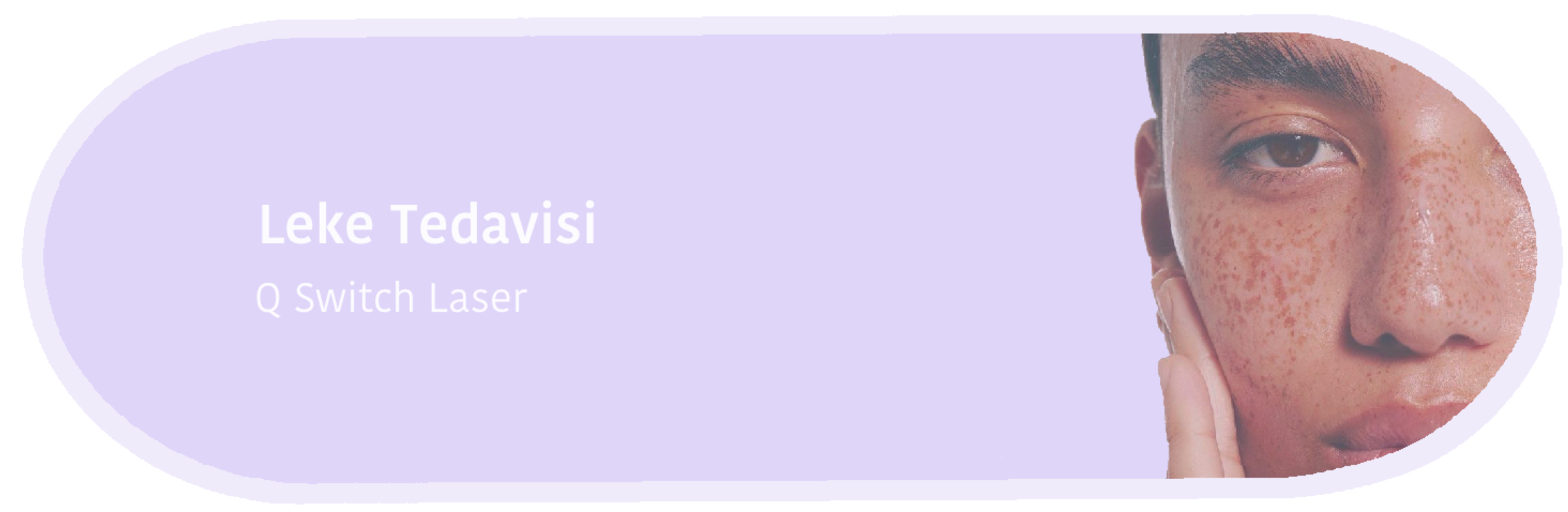 leke-tedavisi
